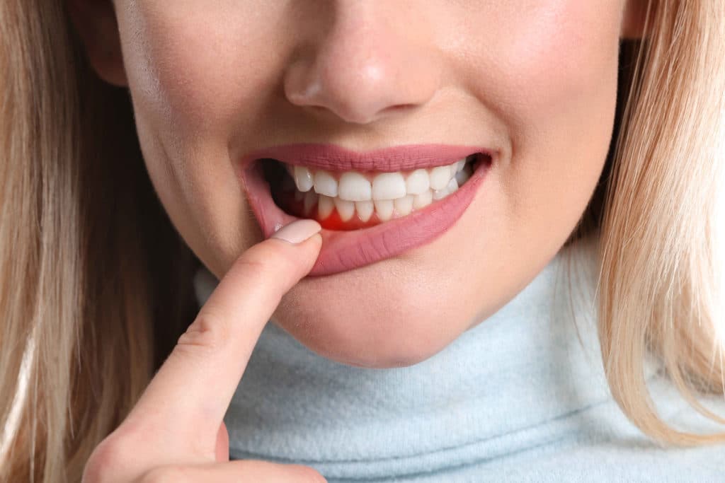 Comment renforcer ses gencives naturellement ? - Magazine de l’Aube